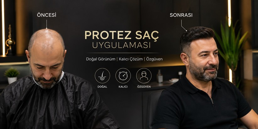 Protez Saç Uygulaması